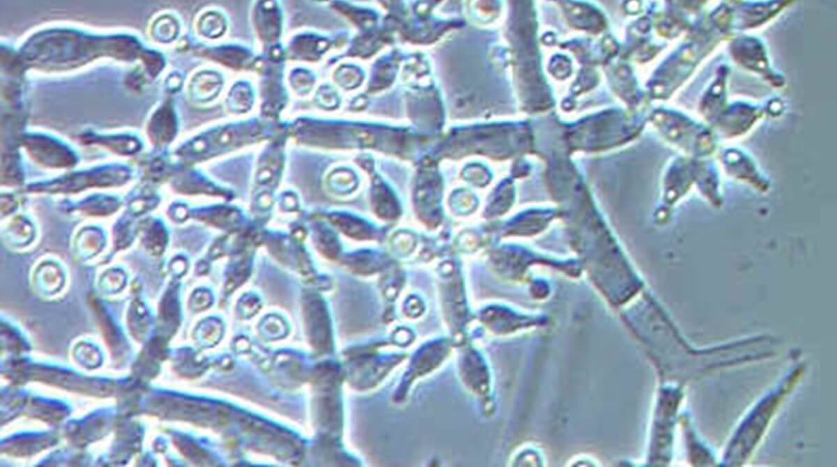 Trichoderma and its potential as a possible complementary tool against ...